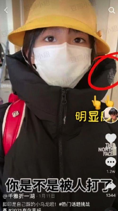 遭校园霸凌网红照片,揭开伤痛背后的真相
